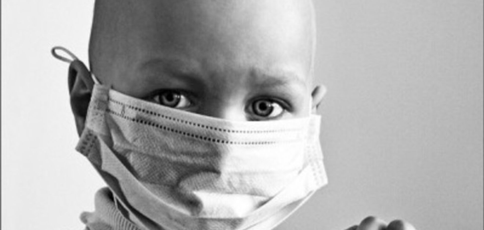 В Україні від раку помирає кожна друга дитина з онкологічним діагнозом