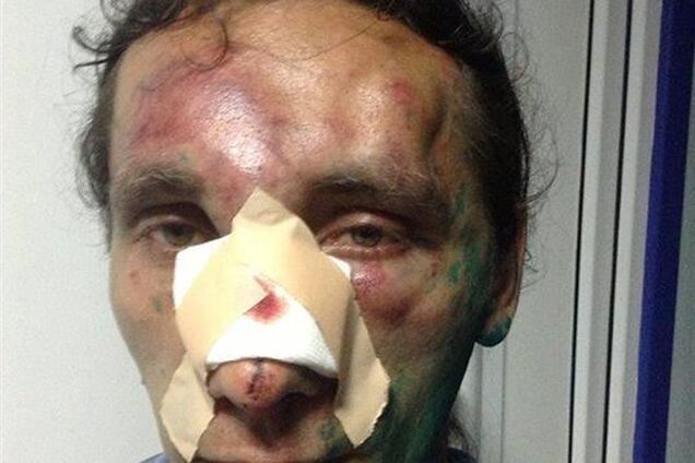 Пострадавшие харьковчане рассказали о зверствах пророссийских сепаратистов