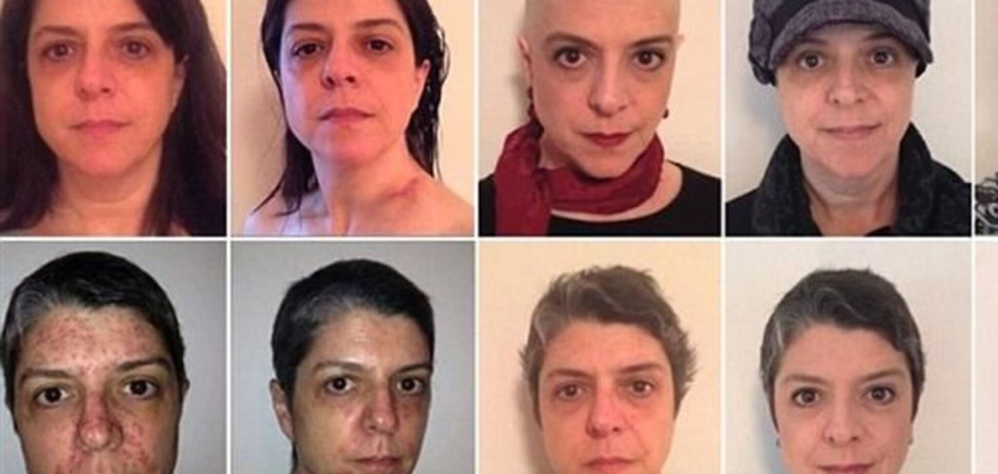 Борьба с раком в фотографиях: от поставленного диагноза до ремиссии