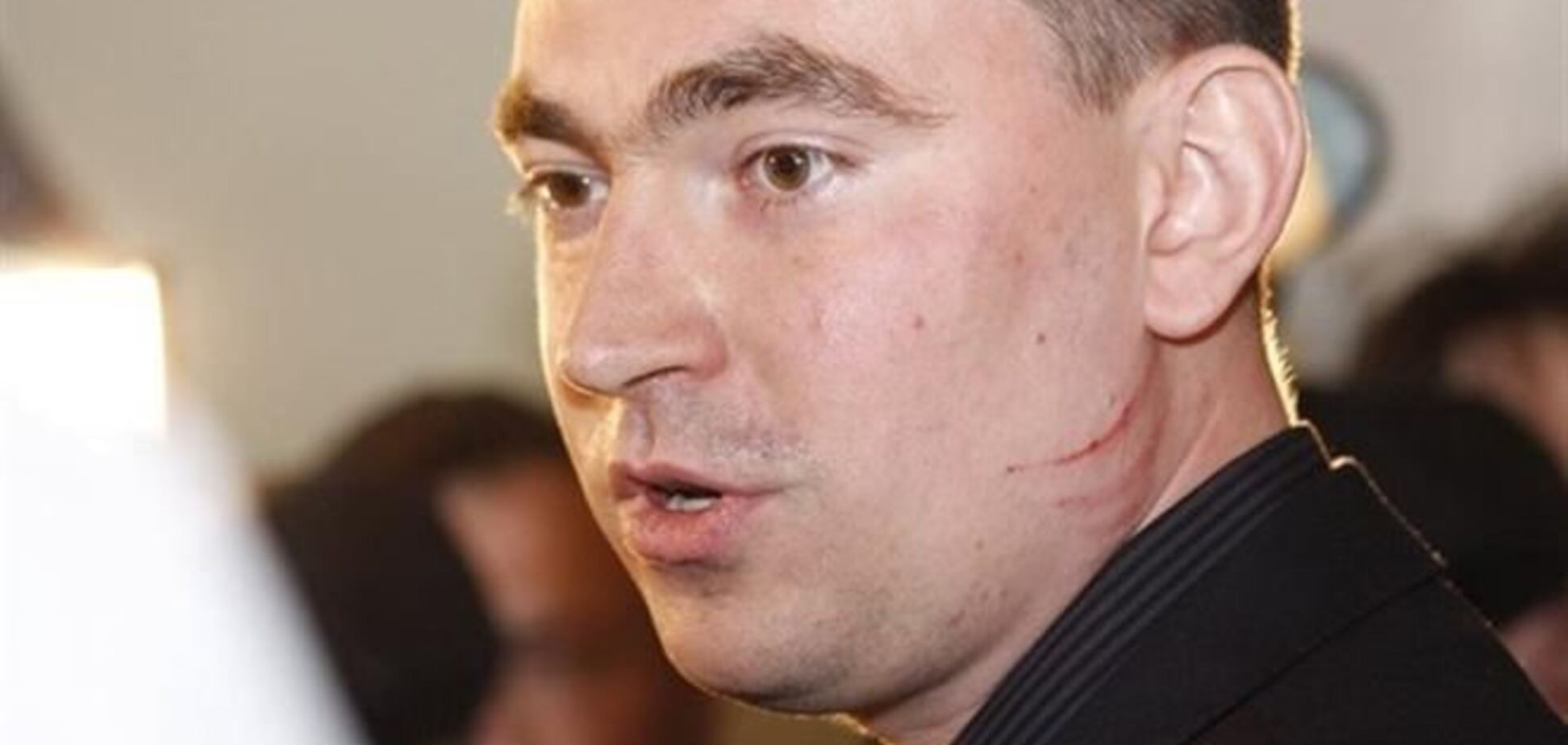 Коммунистка Калетник расцарапала лицо свободовцу Михальчишину