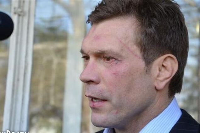 В Николаеве Царева избили и забросали яйцами под крики: 'Чемодан-вокзал-Россия'