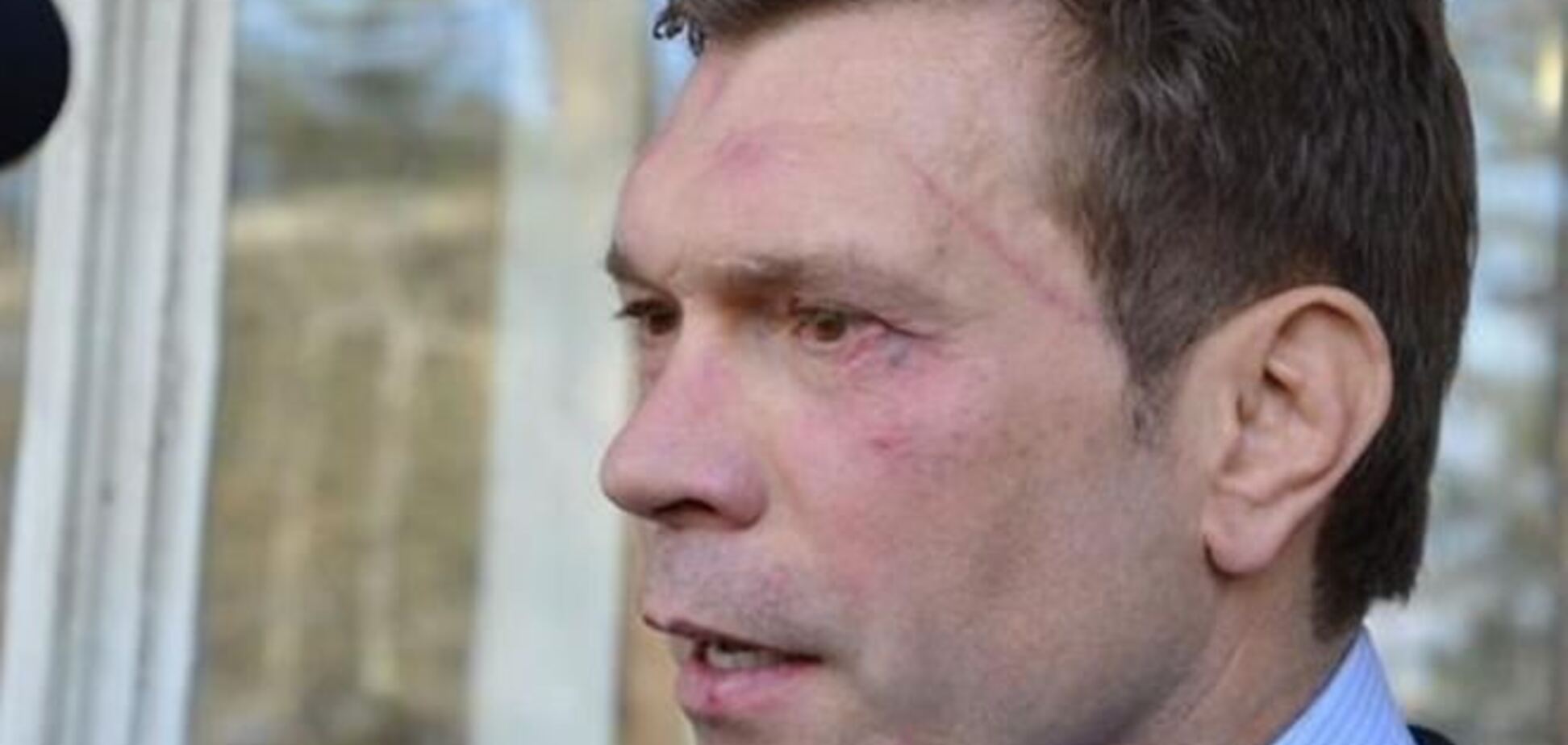 Избитый Царев грозится дать отпор 'бандеровским отморозкам'