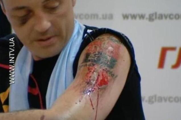 Украина лидирует в рейтинге применения пыток - Amnesty International