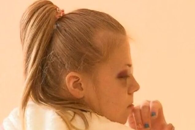 В Ривне подстрелили 13-летнюю девочку