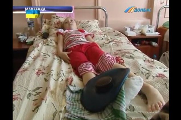 В Макеевке обстреляли людей на остановке: ребенок ранен в ногу, женщина лишилась глаза