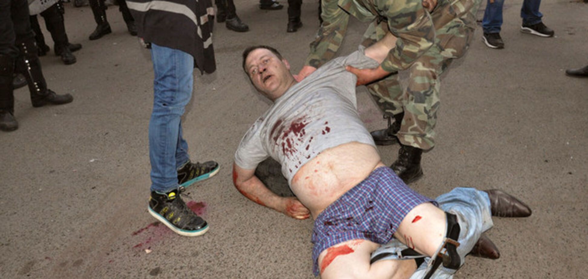 В больницах Одессы остаются 78 человек, пострадавшых в столкновениях 2 мая