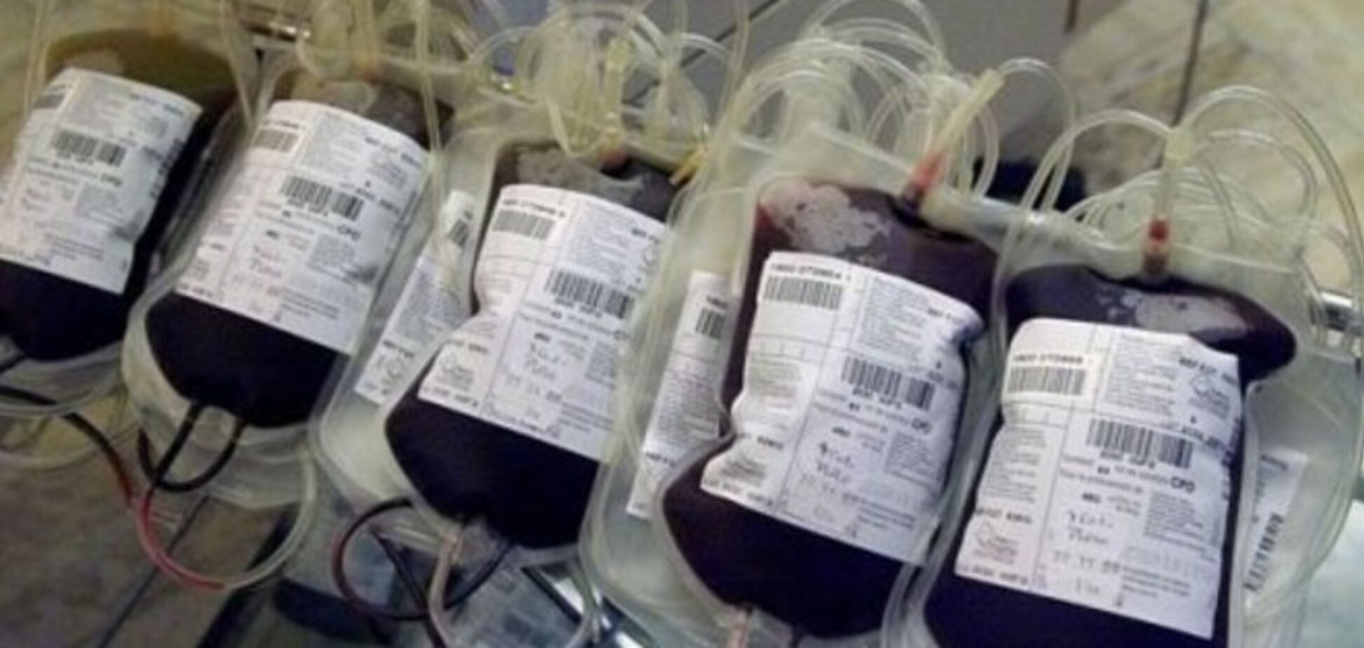 Чтобы быть 'вечно молодым', нужно пройти через переливание крови - ученые