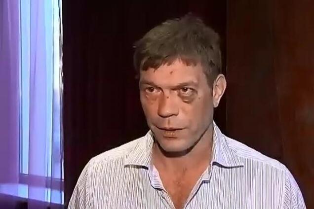 Царев в Луганске назвал себя 'главой Новороссии' и посетил клиническую больницу