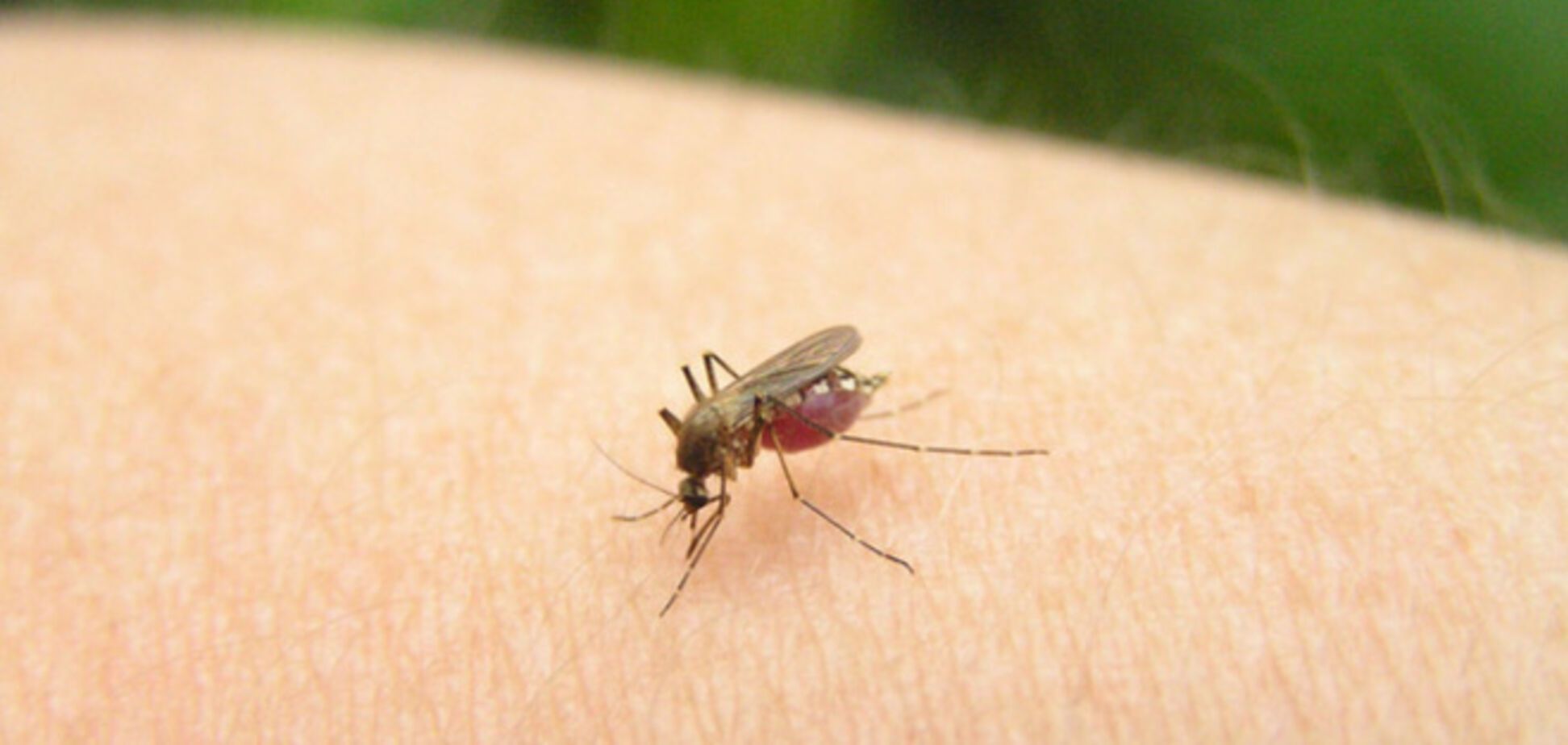 10 способов снять зуд от комариных укусов