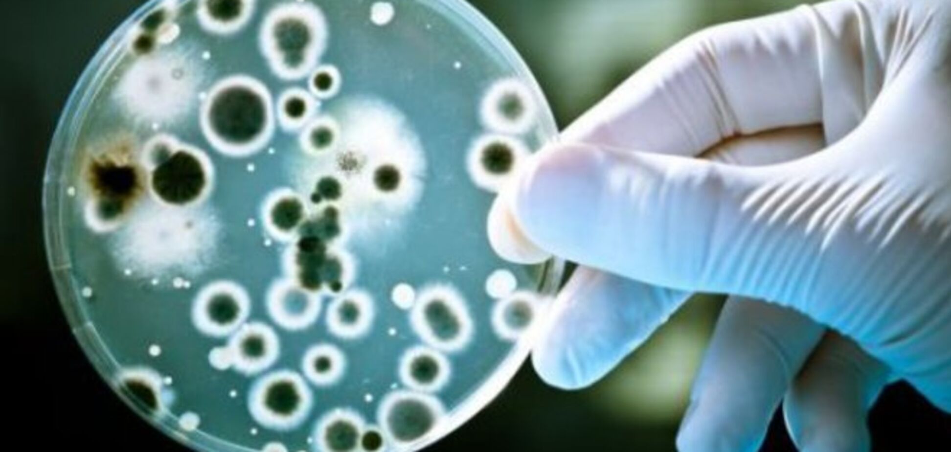 По странам арабского мира распространяется смертоносная супербактерия