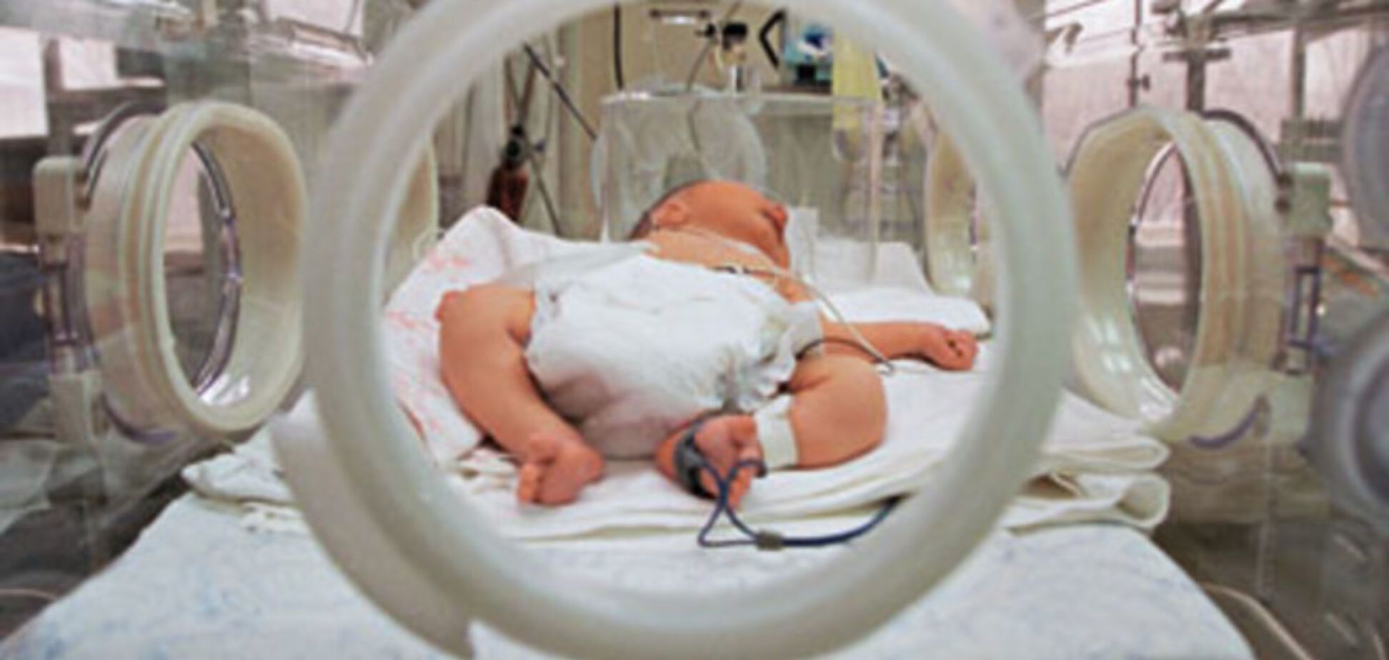 Больше 6 тысяч украинских младенцев умерли из-за плохой медицины 