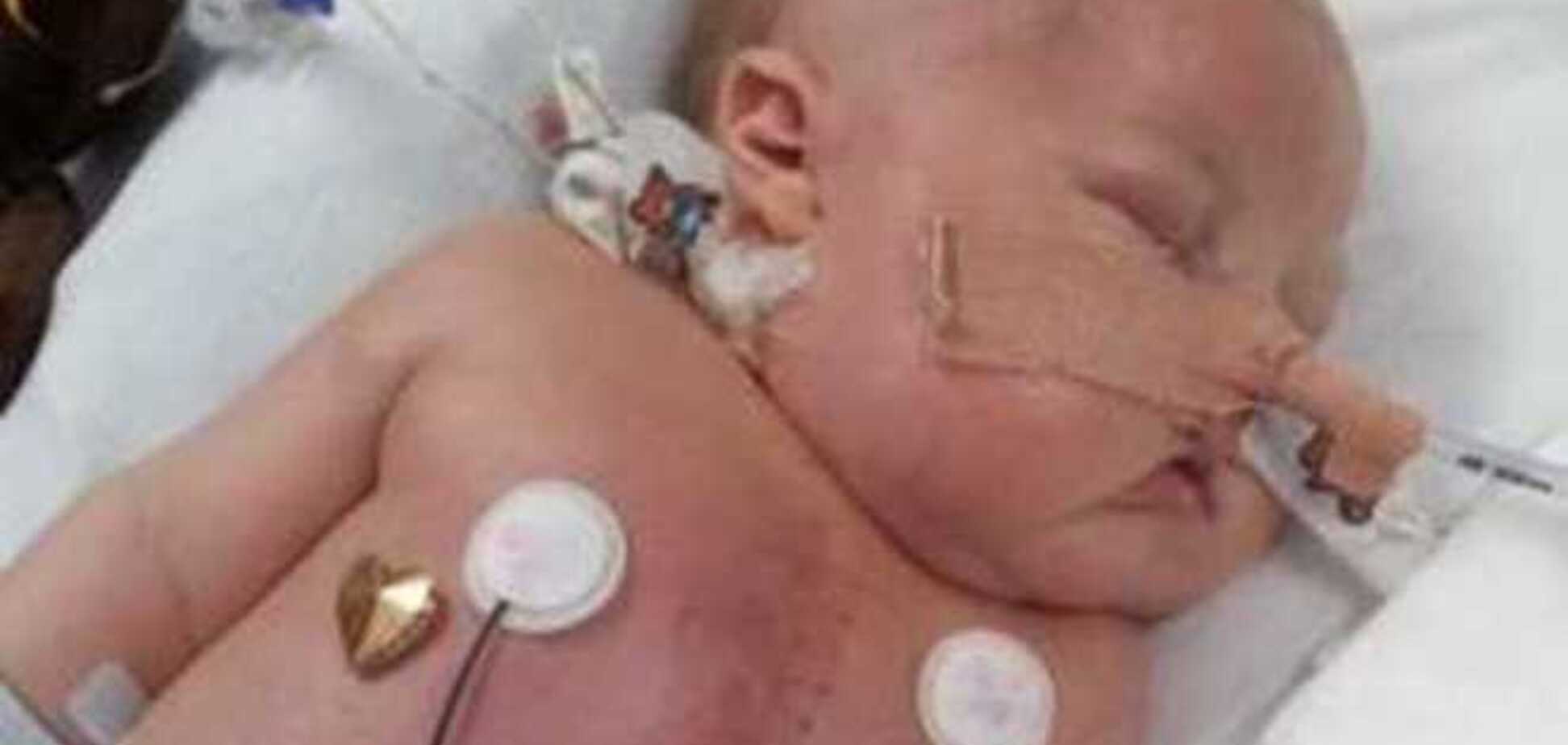 Младенец, нуждавшийся в пересадке сердца, за три месяца исцелил себя сам