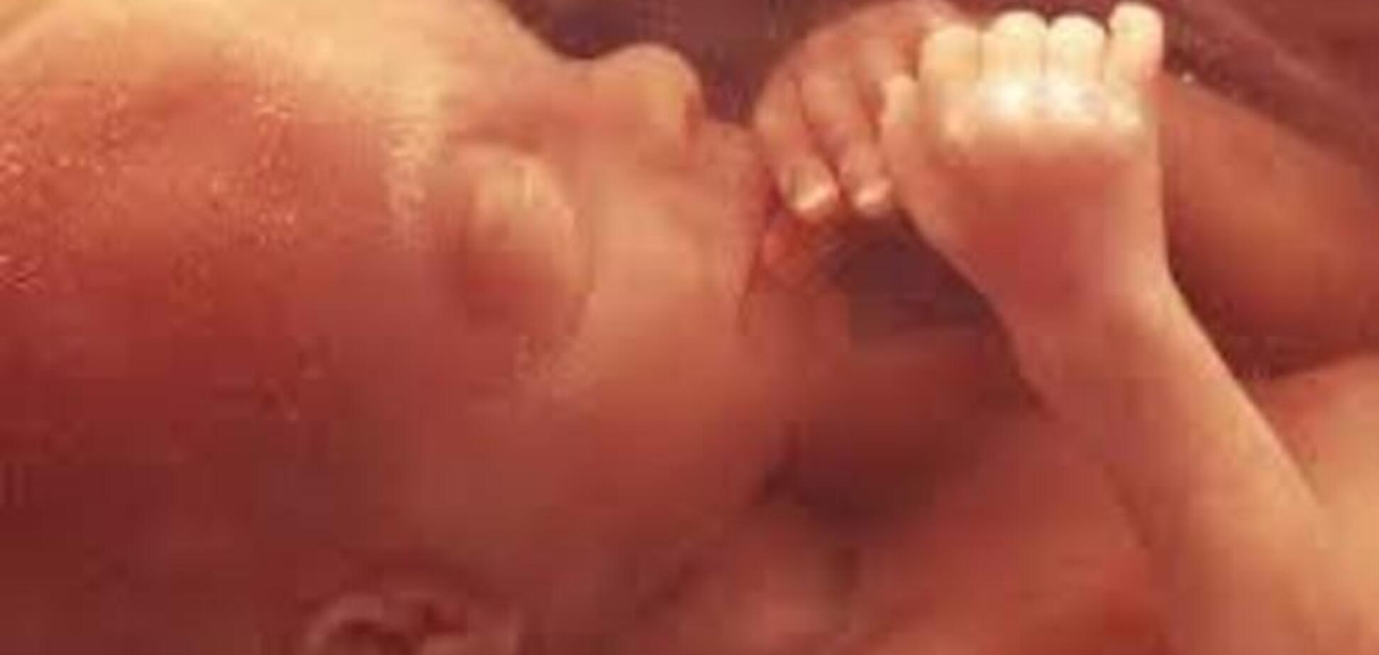 Как формируется лицо эмбриона. Уникальное видео