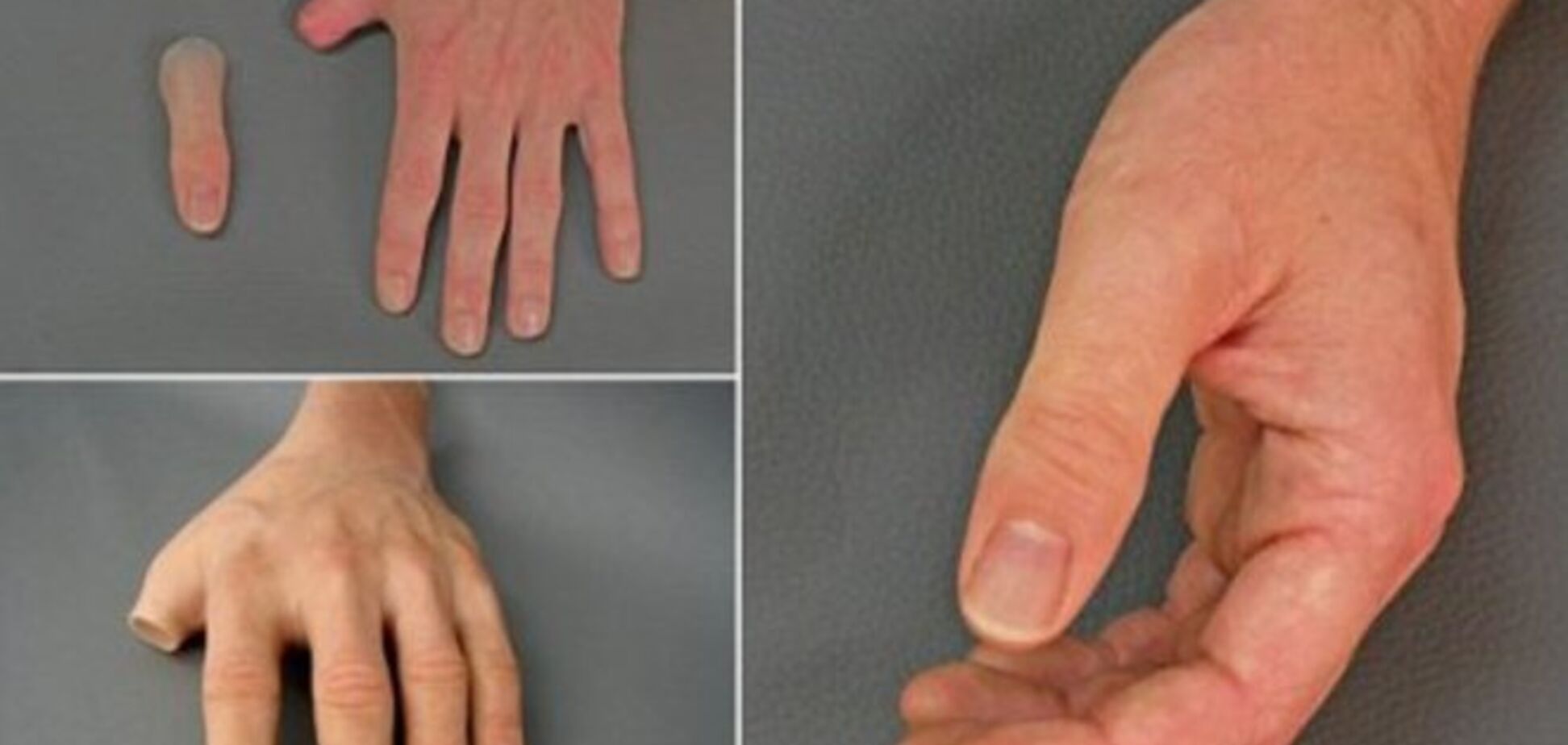 Немцы создали протезы, которые не отличишь от настоящих рук и ног