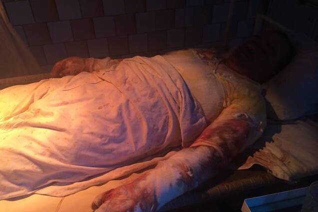 Обгоревших бойцов 79-й бригады россияне допрашивали несколько часов