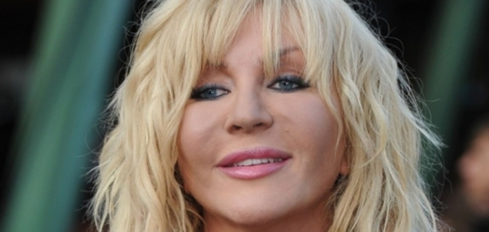 Ірина Білик знівечила особа уколами ботокса