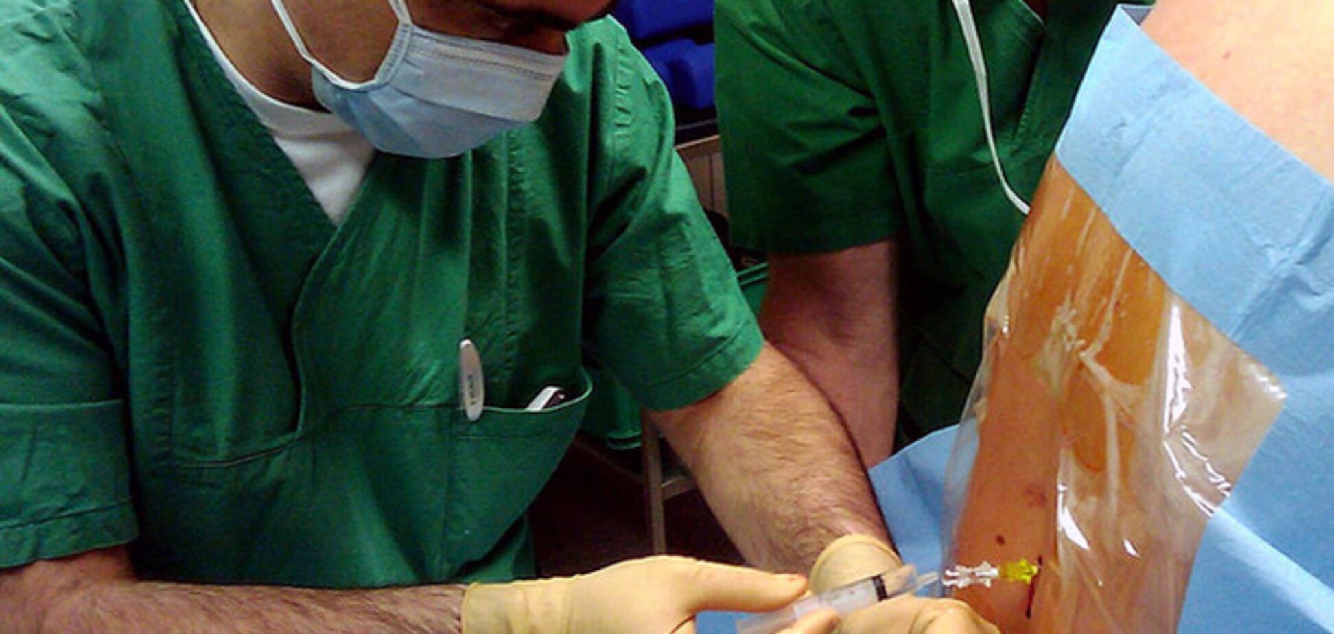 Плюсы и минусы эпидуральной анестезии