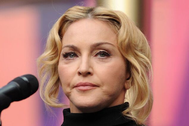 Сын Мадонны 'разукрасил' ее тело синяками