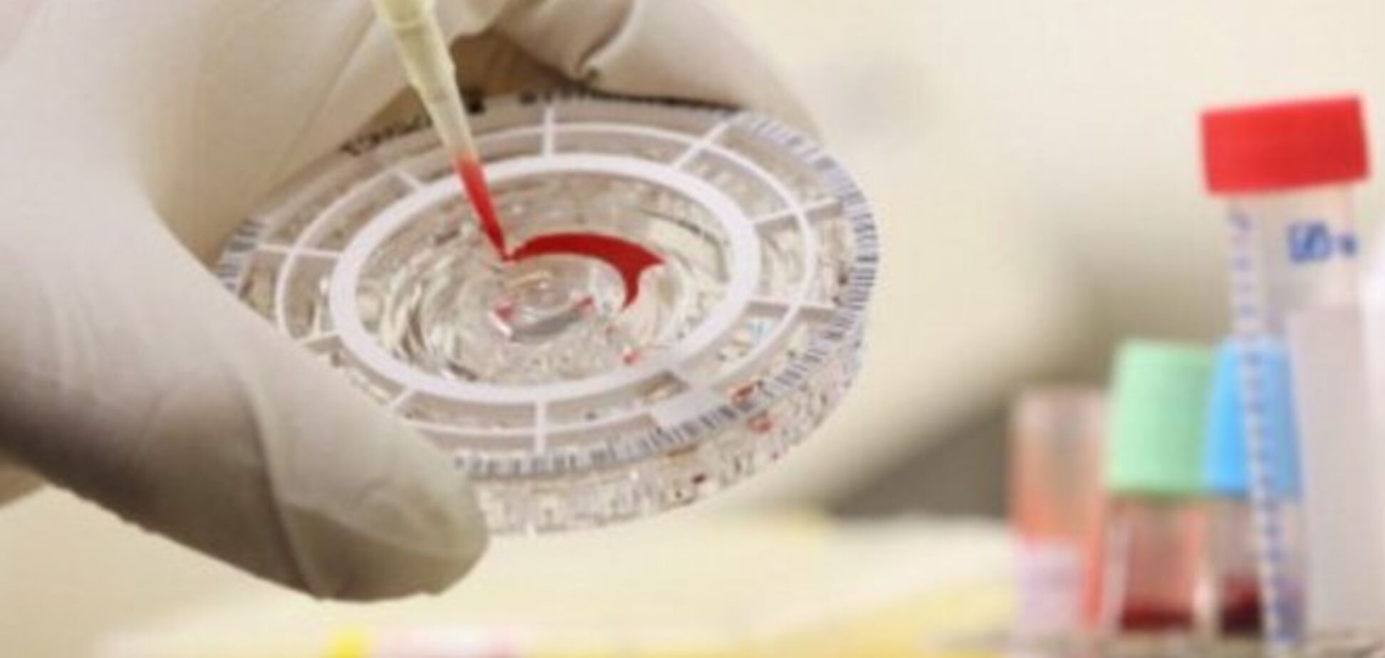 Японцы приготовили лекарства от вируса Эбола