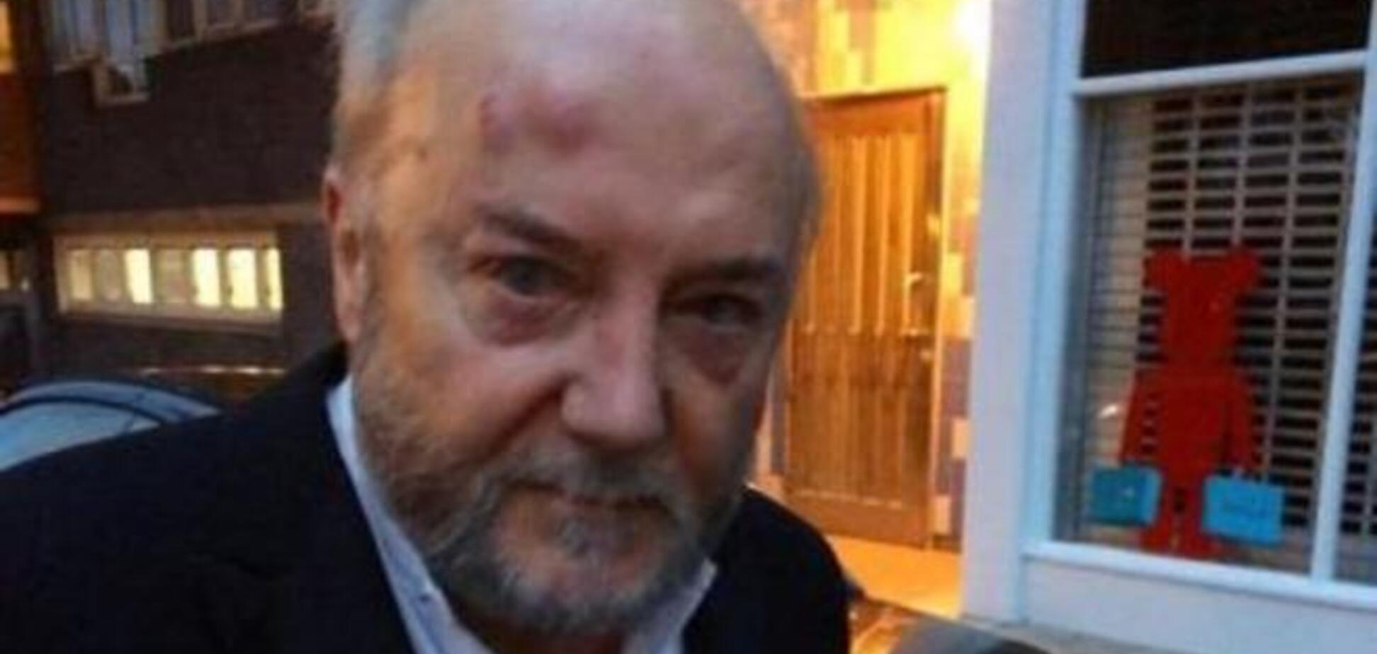 Ведущего Russia Today избили во время фотосессии с поклонниками