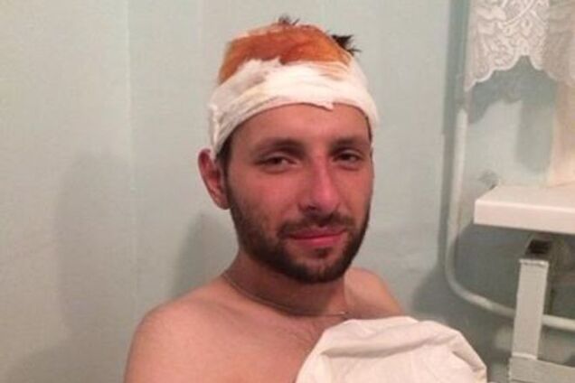 Герой Майдана Парасюк перехитрил русских, чеченцев и 'ДНРовцев' и вырвался из плена