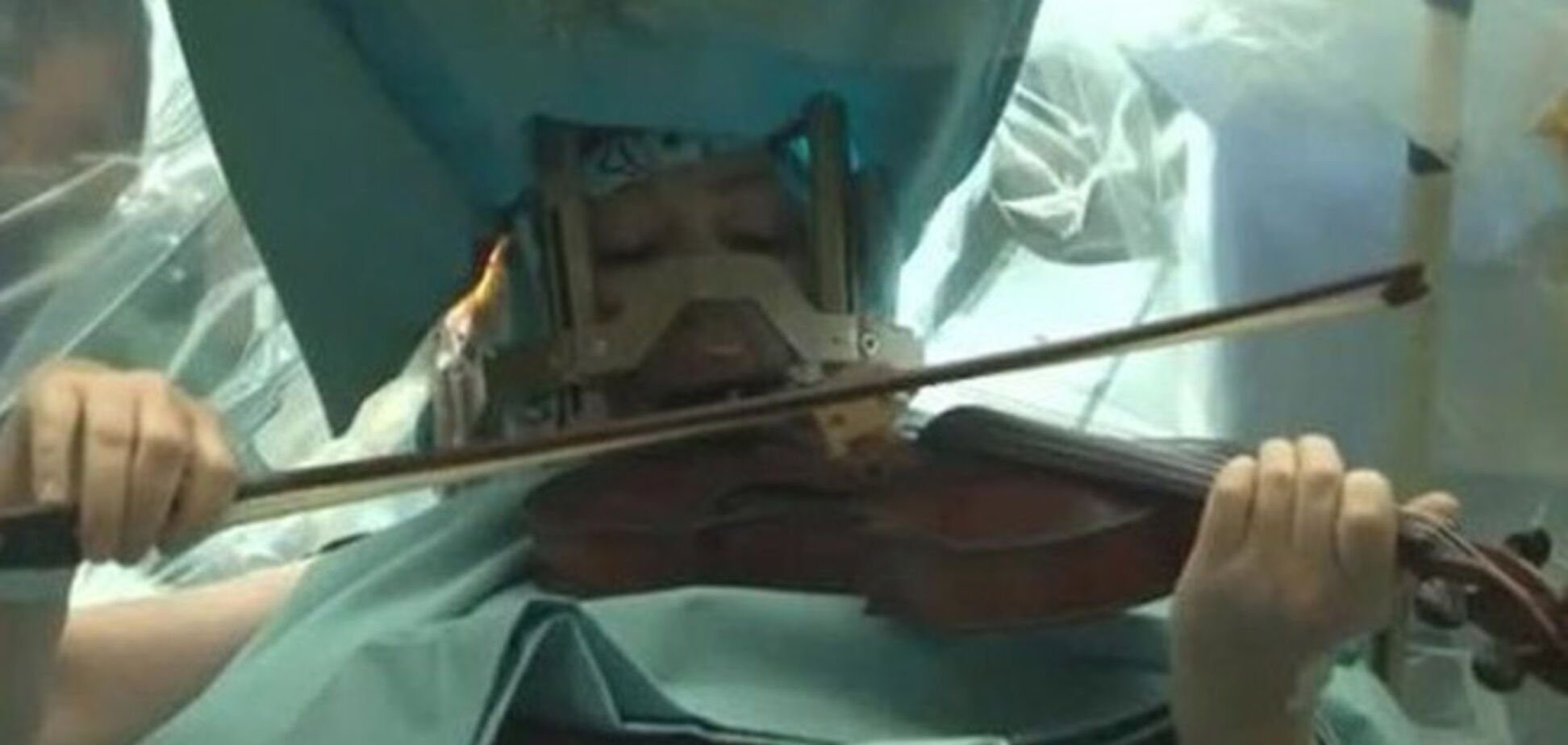 Скрипачка во время операции на мозге играла произведения Моцарта