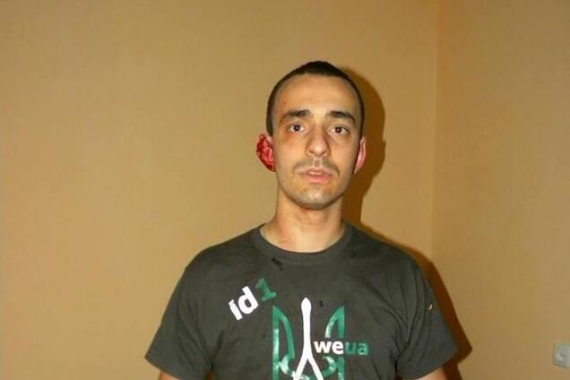 Во Львове сторонница Путина откусила часть уха патриоту за футболку с тризубом