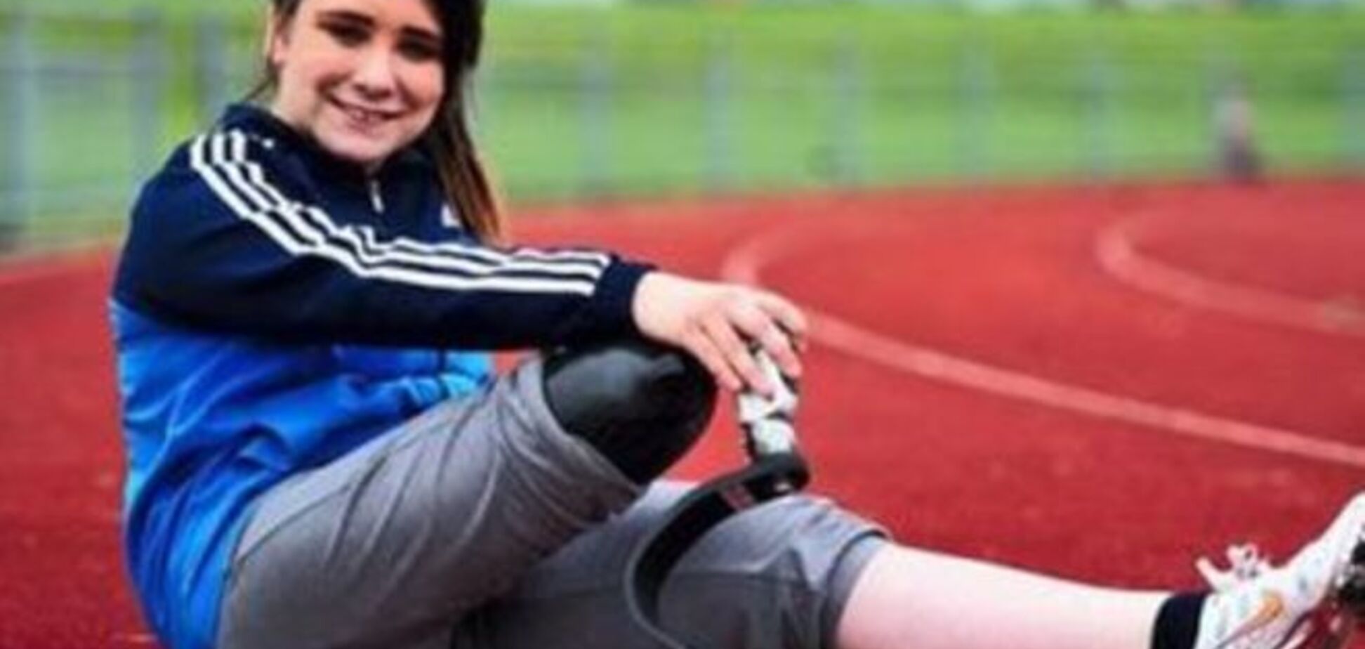 15-летняя девушка хочет ампутировать ногу ради Паралимпиады
