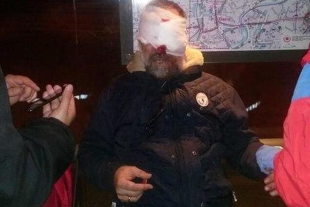 Во время сноса памятника Ленину в Харькове пострадал активист