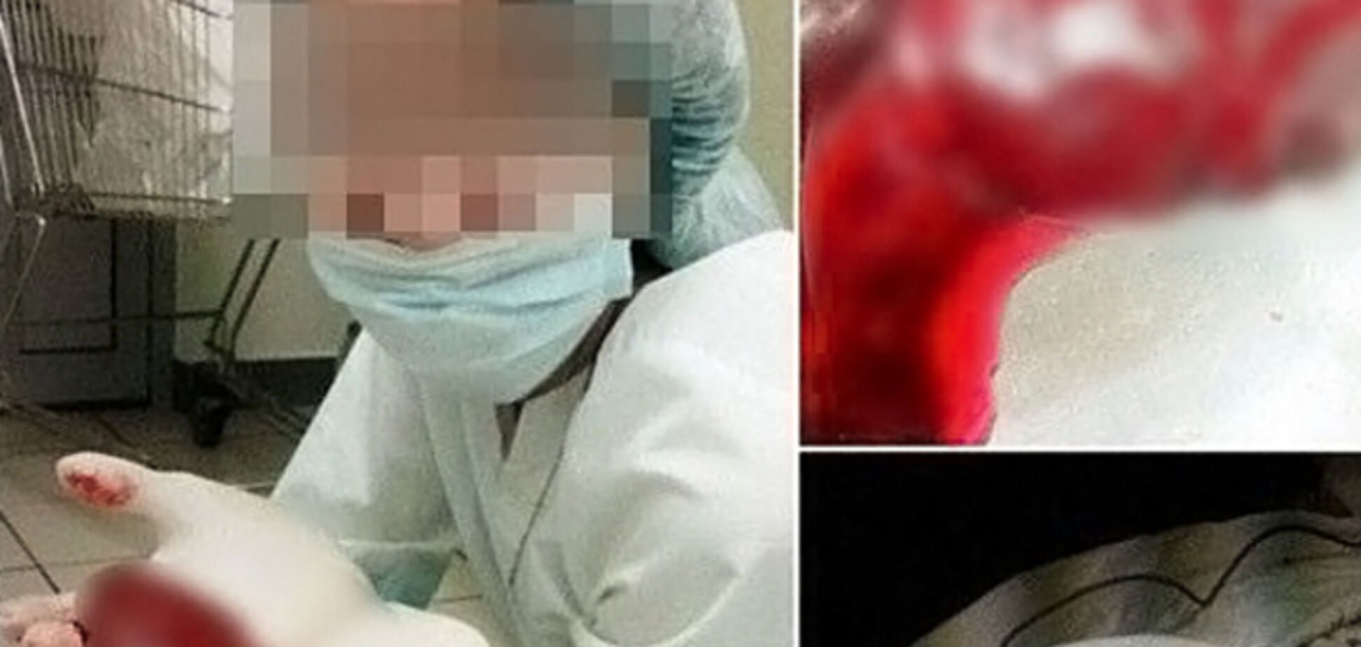 В Казани медработница устроила фотосессию с отрезанными органами