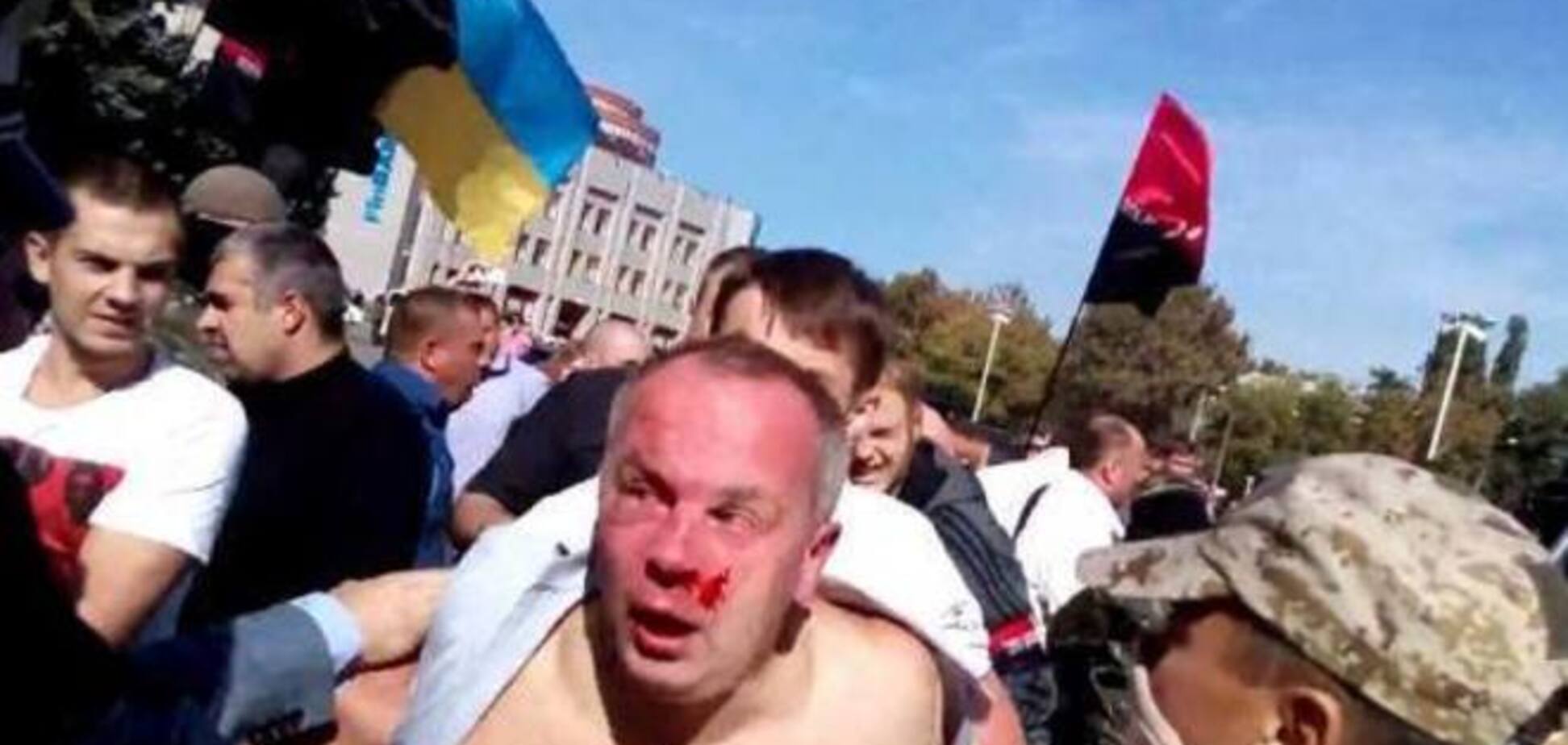 Шуфрич - это цветочки, ягодки - это смерти политиков в ходе столкновений