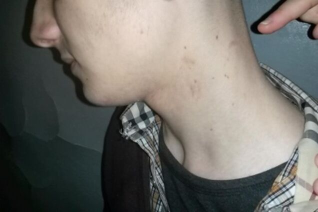 Столичная милиция открестилась от пыток 17-летнего активиста: фото 'потерпевшего'