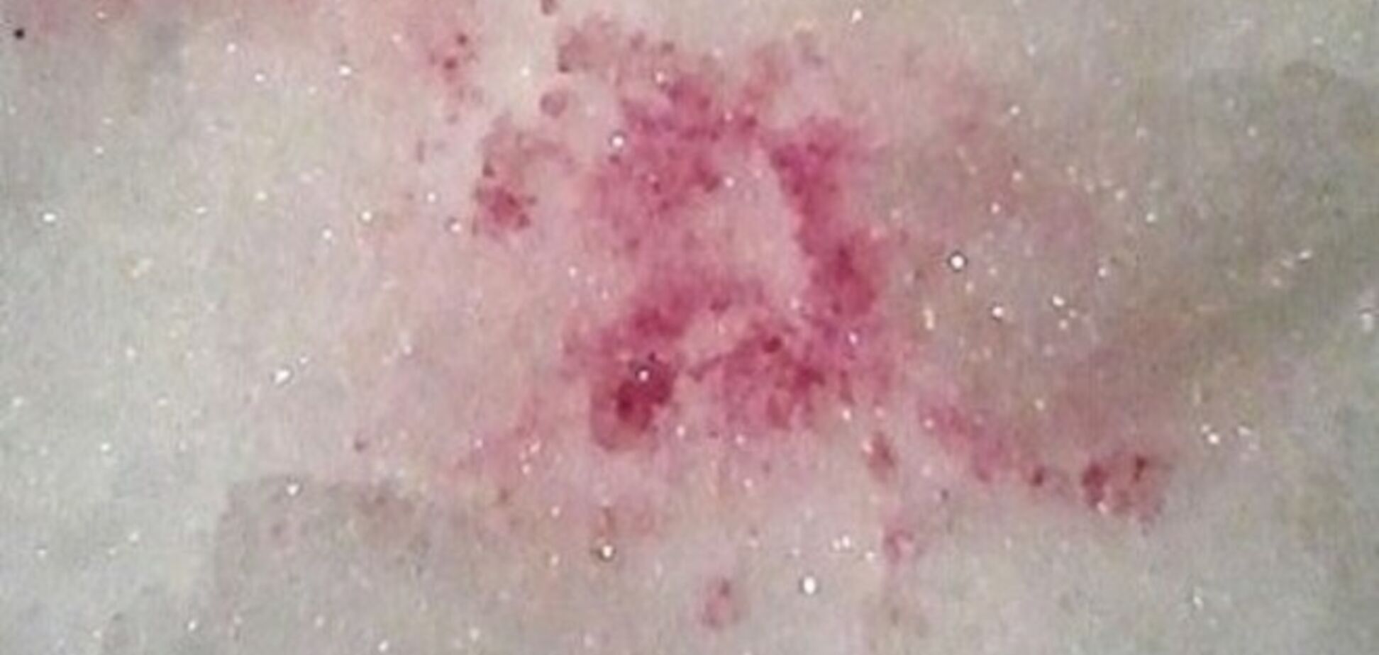 В Киеве неизвестные разбрасывают на снегу яд для собак: фотофакт