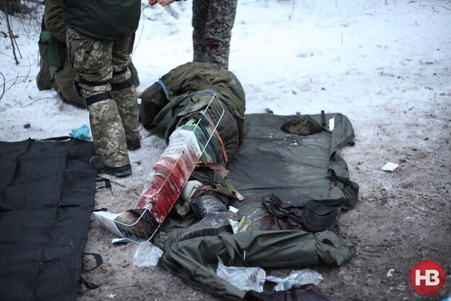 Спасение раненых 'киборгов': душераздирающие фото с передовой