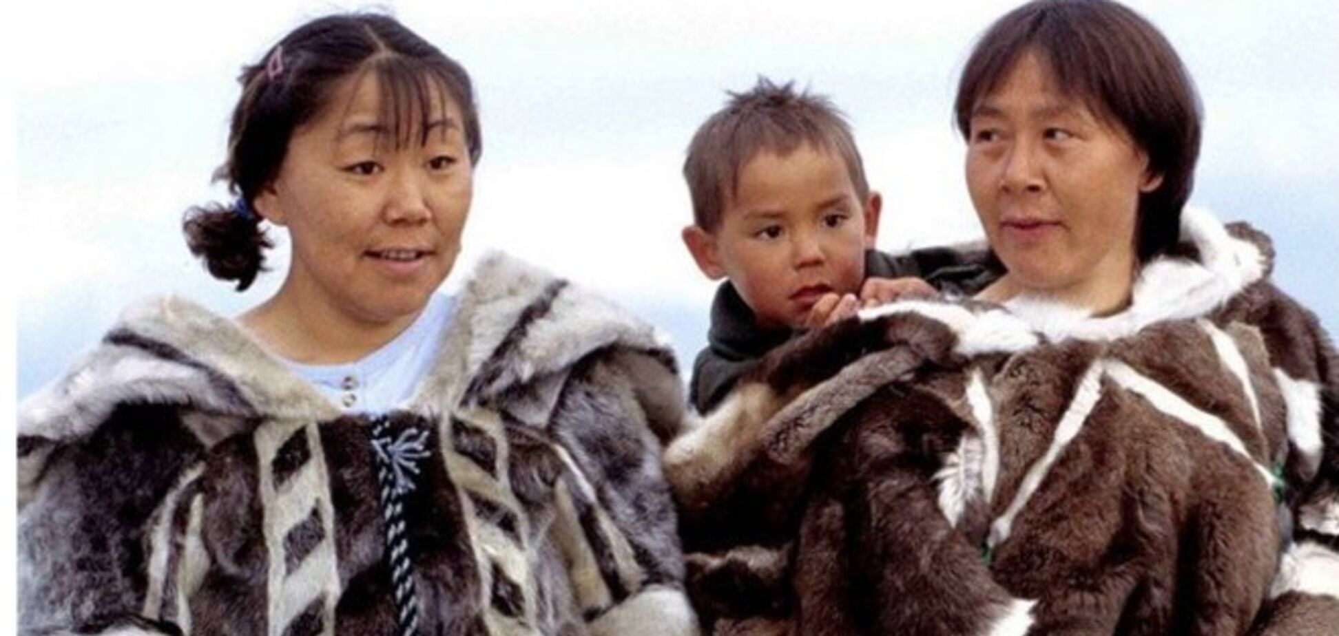 10 удивительных генетических мутаций человека