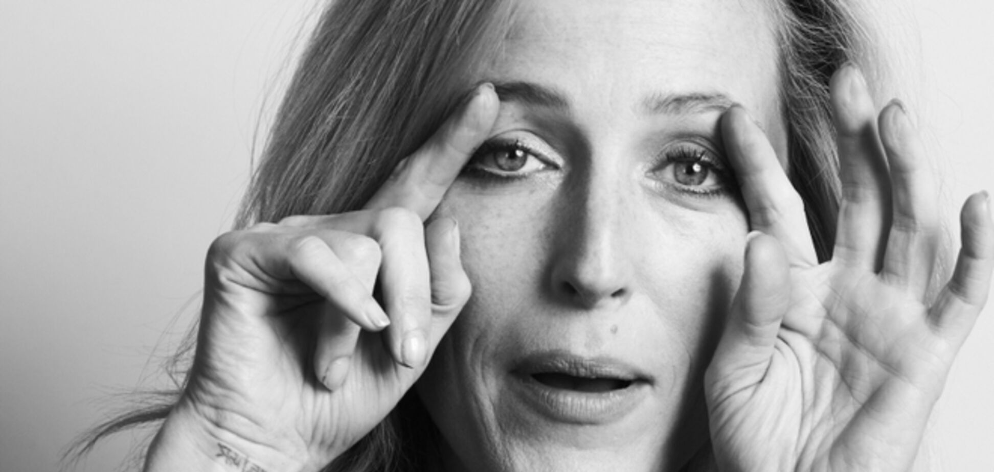 Из-за Собчак 'агента Скали' обвинили в злоупотреблении пластикой лица