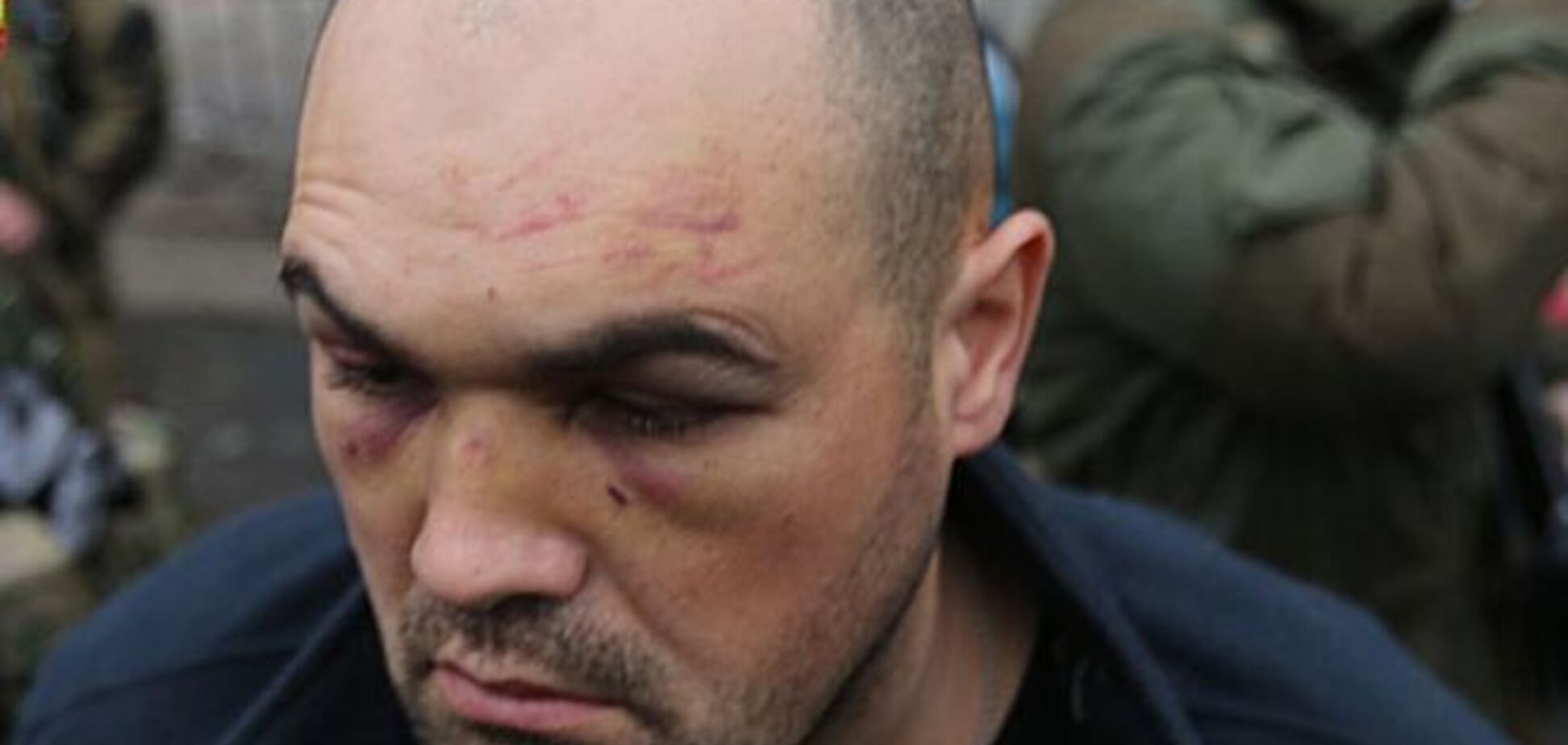 Террорист Гиви специально отслеживал украинского комбата для картинки росТВ, военного ждет судьба Савченко