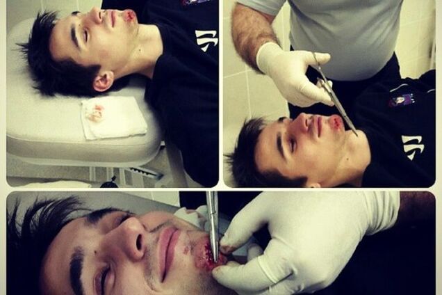 Шайба едва не сделала российского хоккеиста инвалидом: фото не для слабонервных