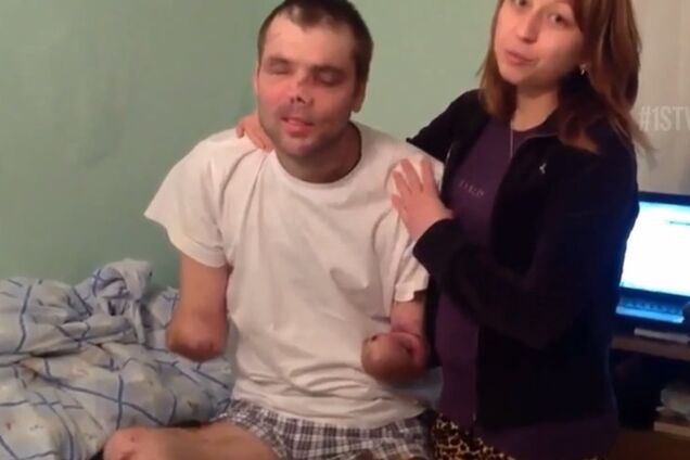 Российский наемник, воевавший за 'ЛНР', лишился зрения и рук: видеофакт (18+)