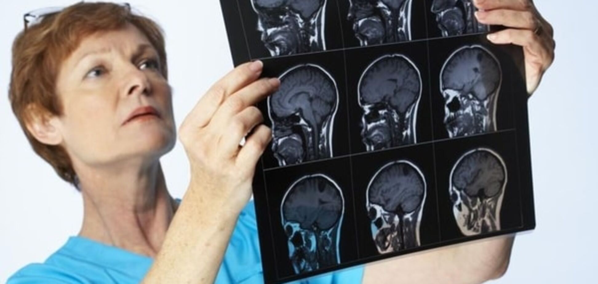 Ученые показали, как происходит заражение мозга менингитом: видеофакт