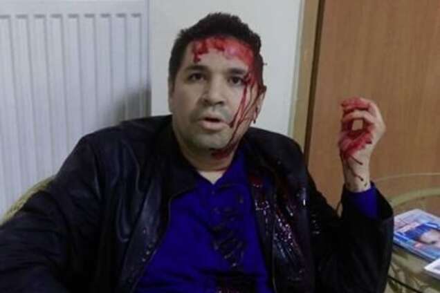 За Кернеса! В Харькове избили кандидата на пост мэра: опубликованы фото