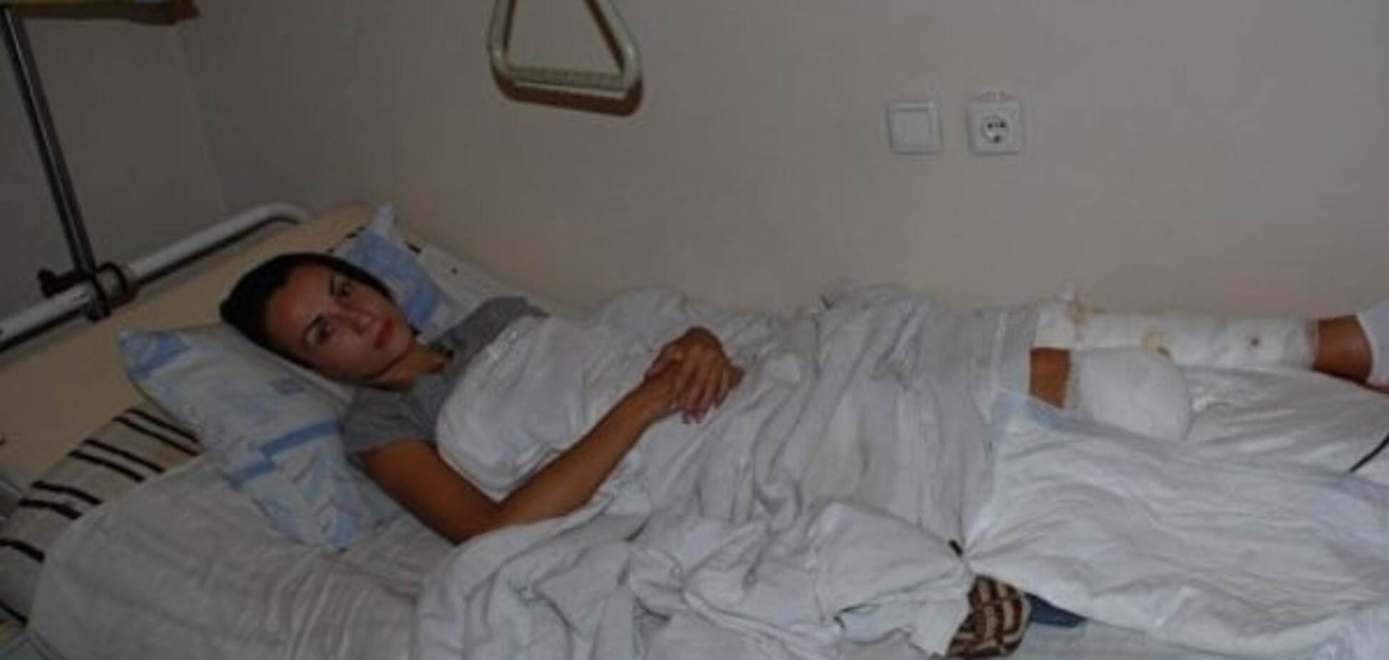 Харьковчанке, уехавшей воевать на Донбасс за террористов, оторвало ногу: опубликованы фото и видео