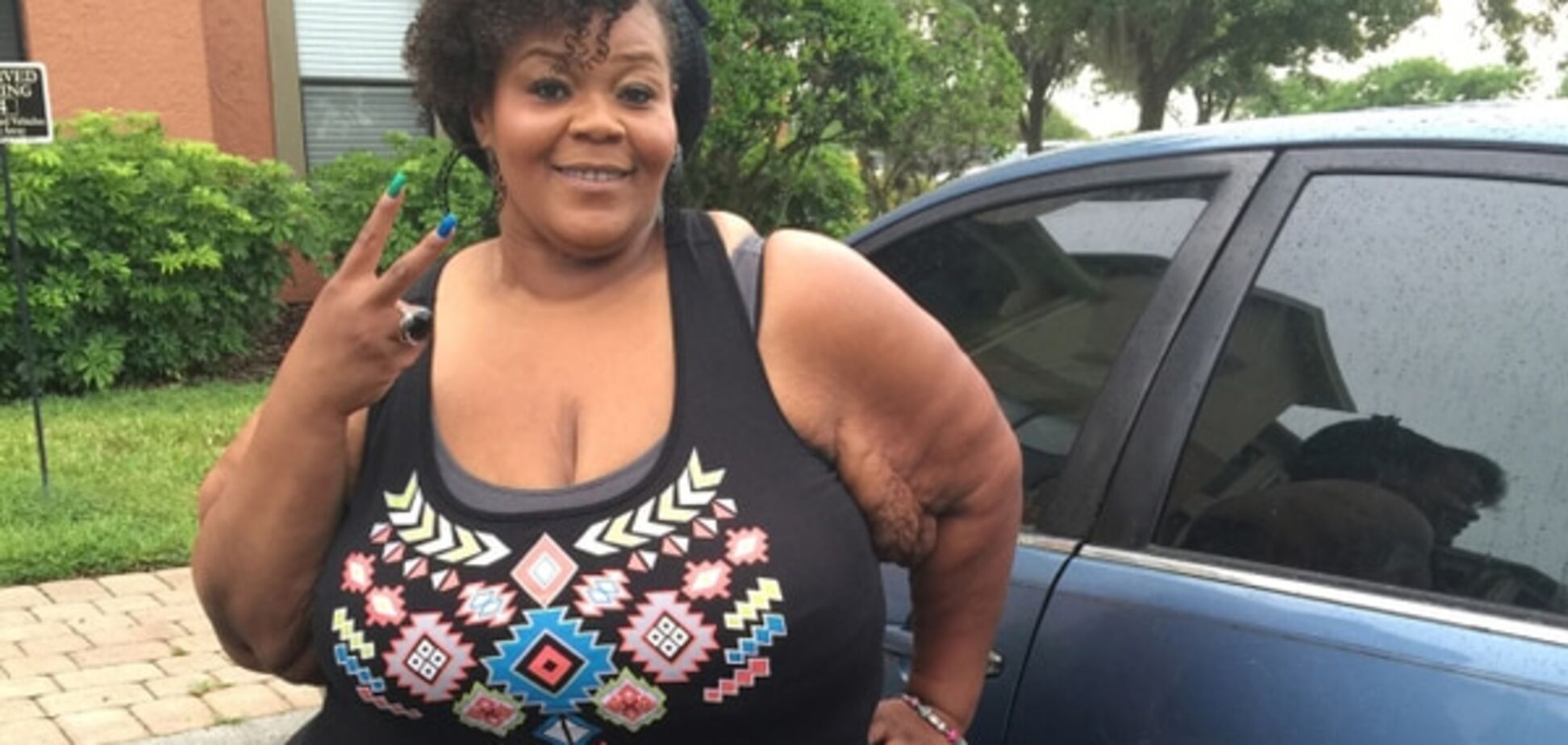 Самая толстая женщина в мире скинула 230 кг: фотофакт