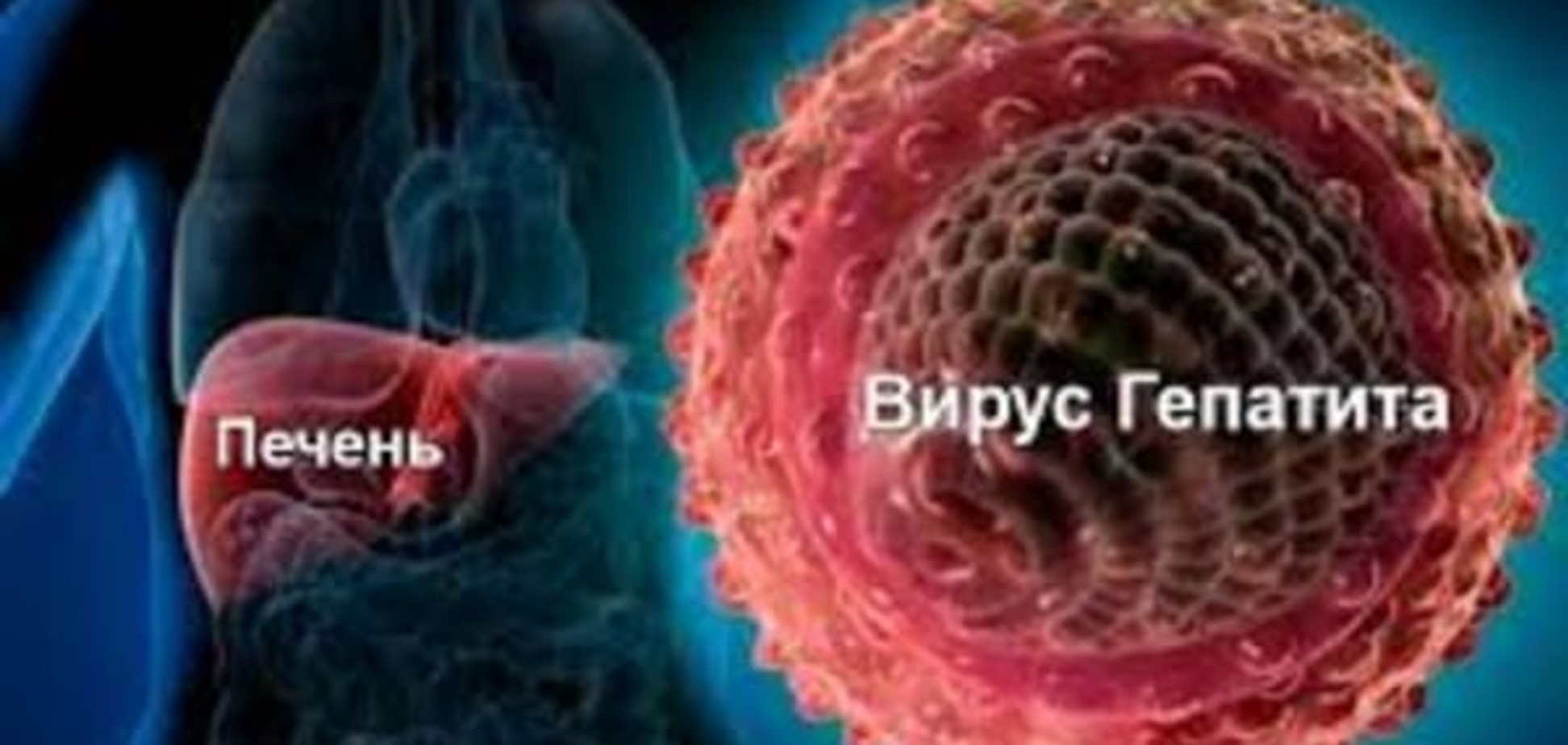 Спалах гепатиту А в Києві: до лікарні потрапили троє дітей