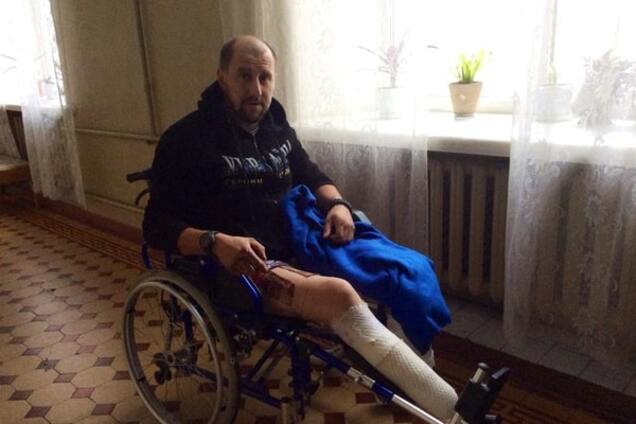 Потерявший в АТО ногу военный нуждается в срочной помощи