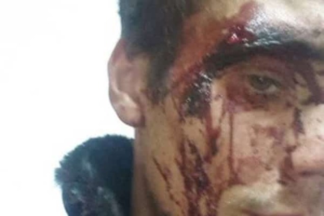 В России жестоко избили переселенцев с Донбасса: фотофакт