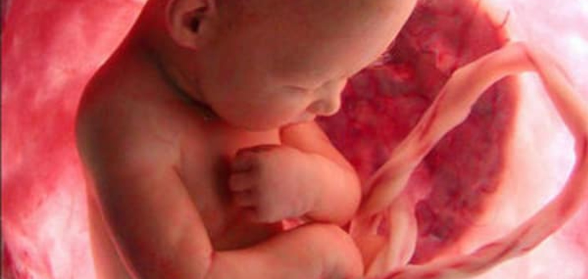 Генетическая аномалия: в США нерожденный ребенок стал отцом