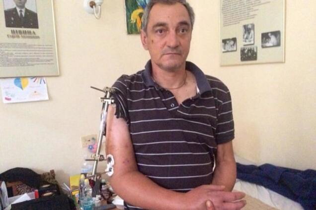 Бойцу АТО, пережившему 12 операций, срочно нужна помощь