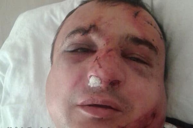 Побитий за хамство Клінчаєв виставляє себе 'жертвою політичних репресій': фотофакт