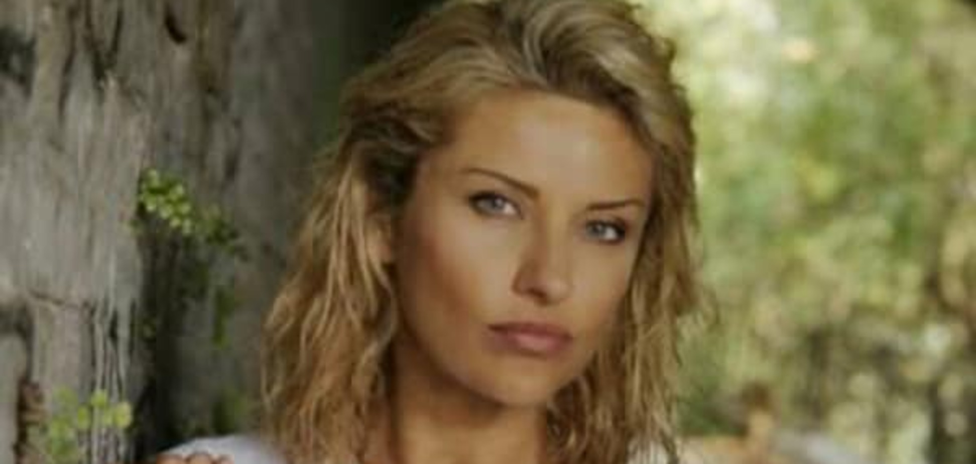 У избитой экс-жены Башарова нашли опухоль мозга